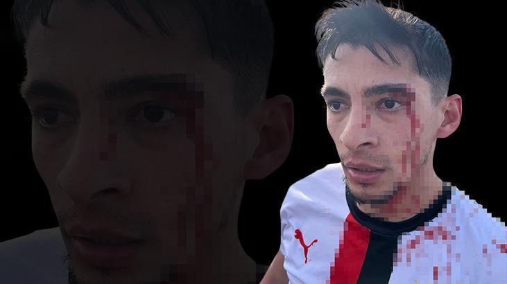 Amatör futbol maçında kavga çıktı, 3 futbolcu hastanelik oldu