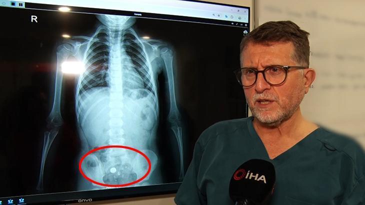 Parkta buldu, şeker diye yuttu! 4 yaşında çocuğu ölümden döndüren süreç röntgen filminde: Hareket halinde